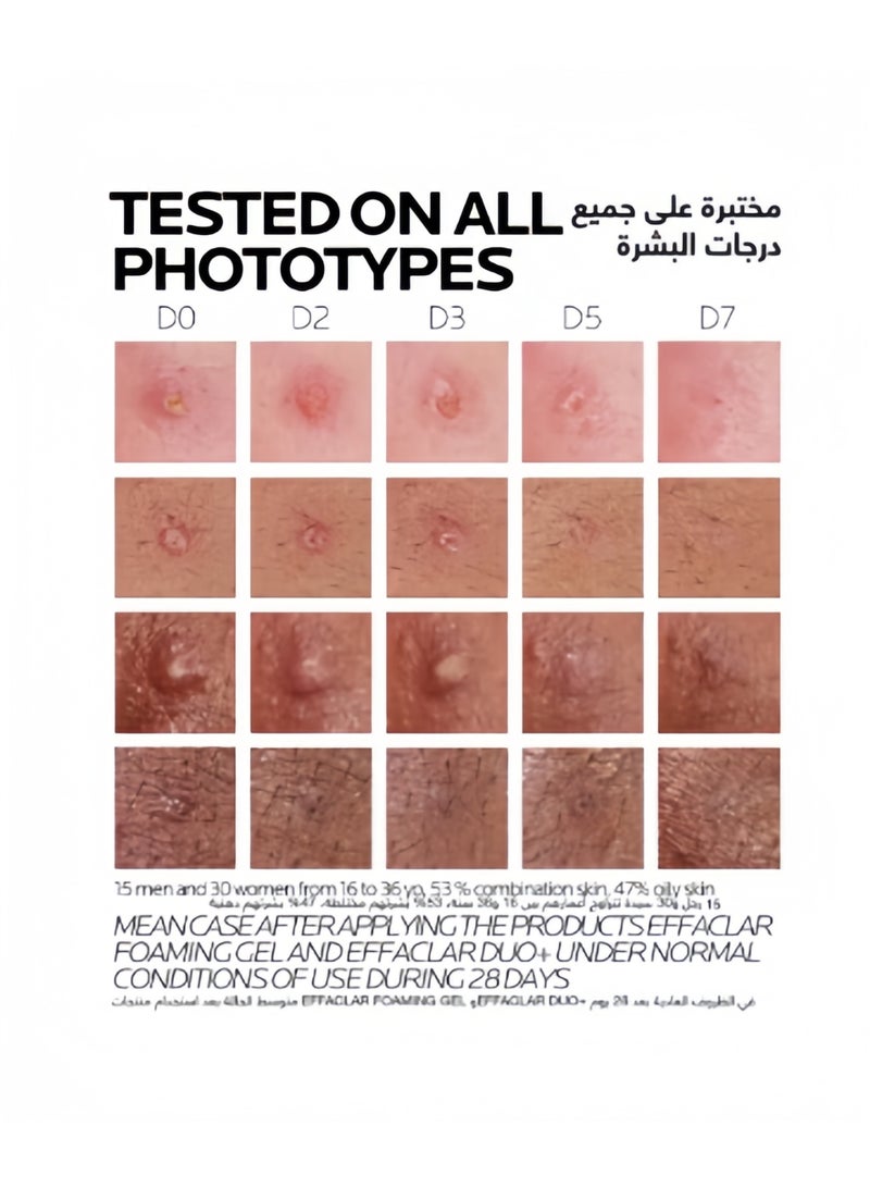 Effaclar Duo+M Acne Treatment Cream For Oily And Acne Prone Skin 40ml - Image 4